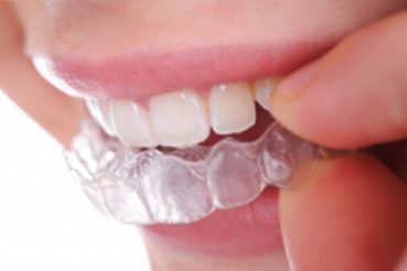 Zahnklinik Ungarn – Zahnimplantate